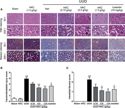 Huangkui Capsule Ameliorates Renal Fibrosis in a Unilateral Ureteral Obstruction Mouse Model Through TRPC6 Dependent Signaling Pathways